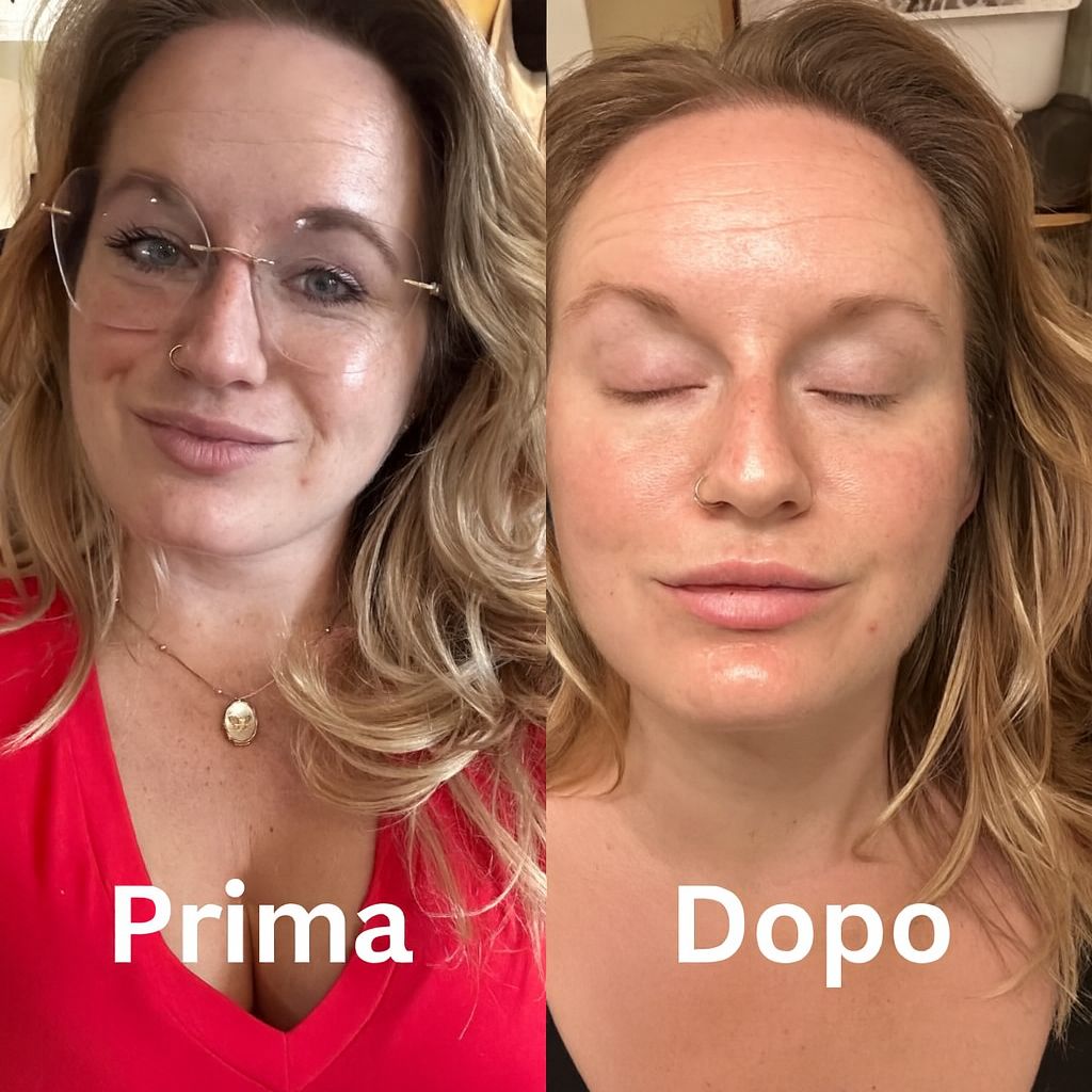 La Tua Pelle, Ma Più Luminosa